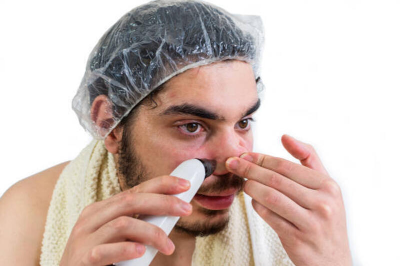 foto closeup seorang pemuda yahudi yang mengeluarkan komedo di hidungnya - alat penyedot komedo potret stok, foto, &amp; gambar bebas royalti