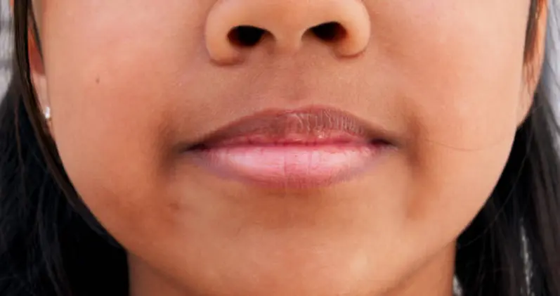 Punya Bibir Gelap? Ini Penyebab dan Cara Merawatnya