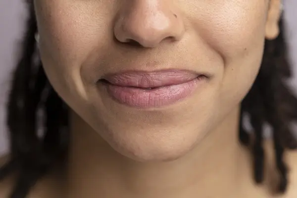 Bibir Kering Akibat Perubahan Cuaca: Kenali Cara Mengatasinya!