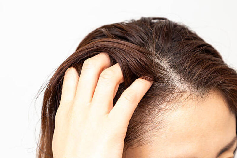 seorang wanita paruh baya yang peduli dengan rambutnya. - kulit kepala sensitif potret stok, foto, &amp; gambar bebas royalti