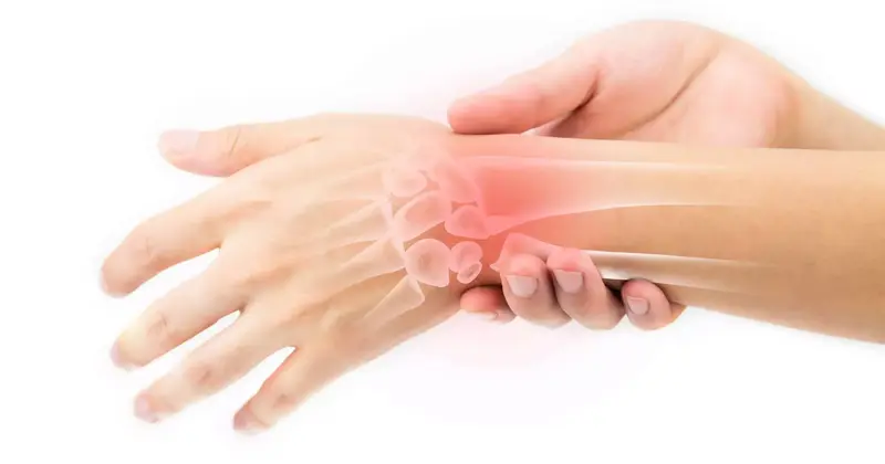 Repetitive Strain Injury (RSI) | Orchard Health Clinic - Osteopathy,  Physiotherapy and Chiropractic