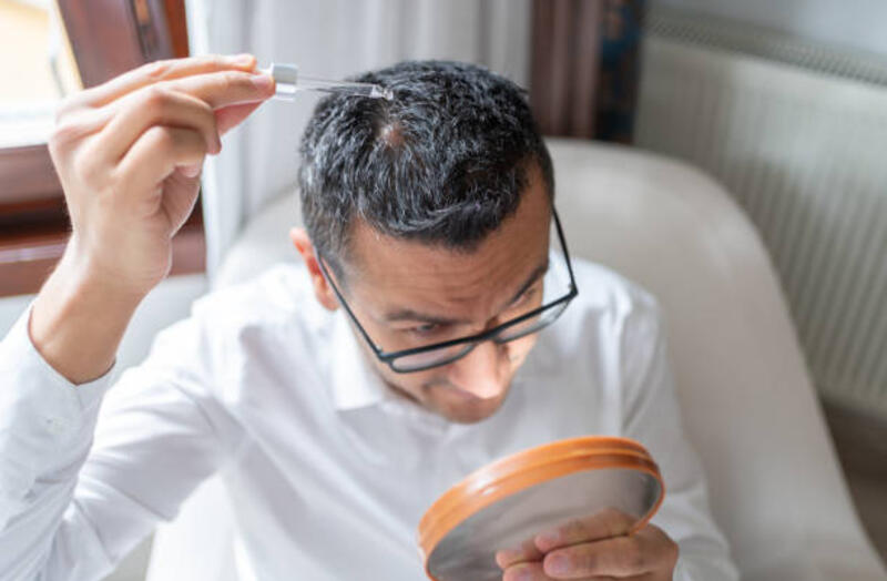 terapi penetes cair pada lipoma kulit kepala - applying hair tonic potret stok, foto, &amp; gambar bebas royalti