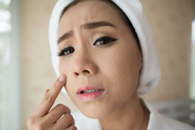 Kulit Wajah Kering? Jangan Panik, Ini Cara Mengatasinya!