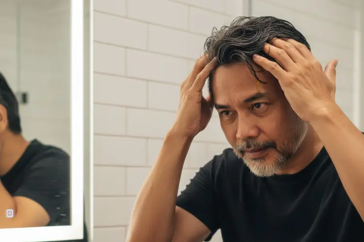 Takut Uban Dini? Minyak Kemiri Jadi Solusi Alami untuk Rambut Hitam Berkilau