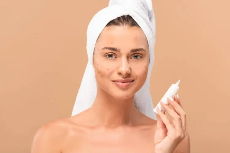 Obat Acne Spot Dipakai Setelah Apa? Perhatikan Hal-hal Ini Dulu