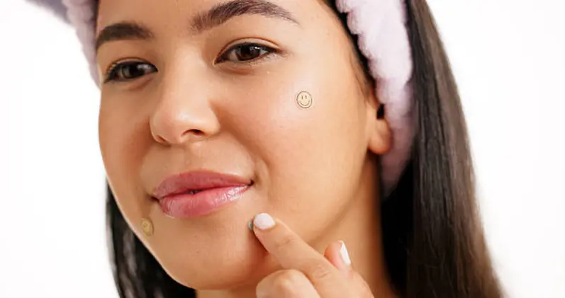 Rawat Jerawat dengan Acne Patch, Terapkan Cara Hebat Ini!